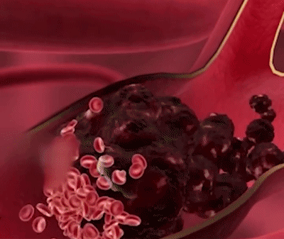 10.gif